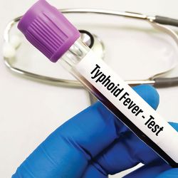 Fever Thypoid Test