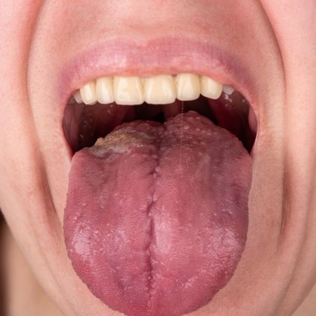 Oral intim