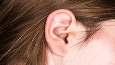 Penyebab Komedo di Telinga dan Cara Mengatasinya