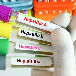 Premium Screening Hepatitis