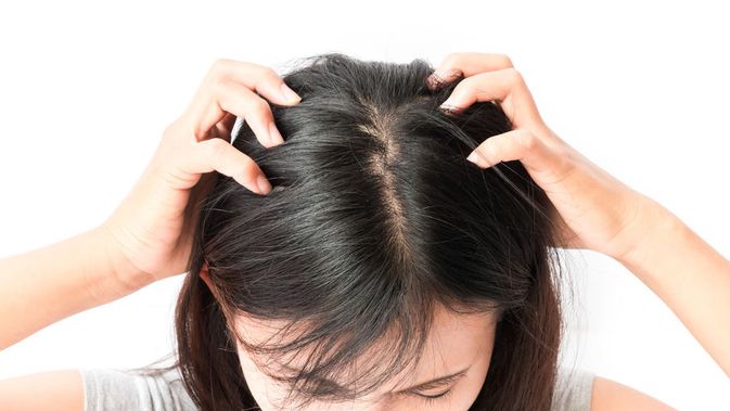Fakta Tentang Kutu Rambut yang Anda Harus Tahu - Info Sehat Klikdokter.com
