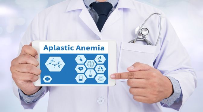 Anemia Aplastik