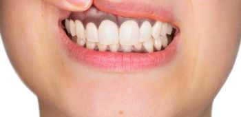 Cara mengobati sakit gigi berlubang yang tak kunjung sembuh