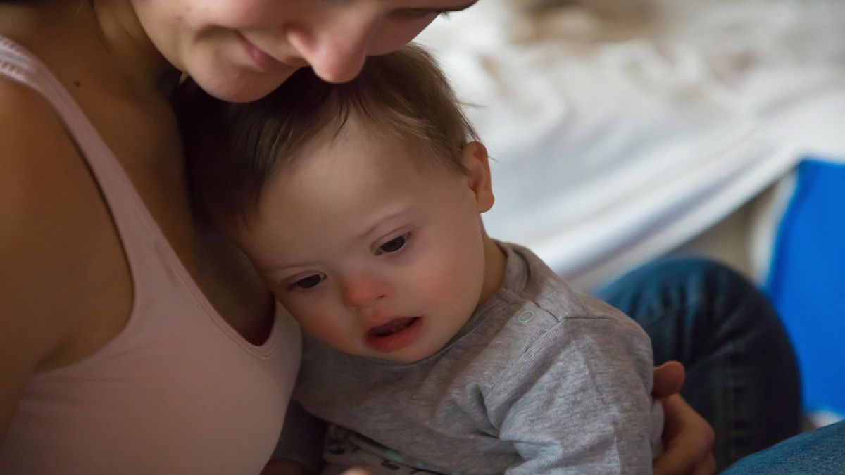 Bentuk Wajah Datar pada Bayi Down Syndrome