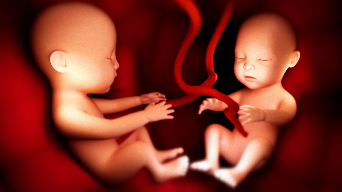Tanda Dan Gejala Kehamilan Kembar Yang Jarang Disadari