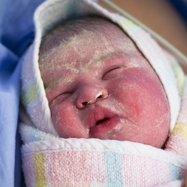 Vernix Caseosa pada Bayi Baru Lahir, Apa Sebabnya?