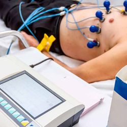 Pemeriksaan Elektrokardiografi (EKG/ECG) + Interpretasi Dokter Jantung