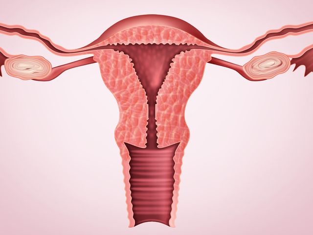 Endometrium gejala hiperplasia Penebalan Dinding