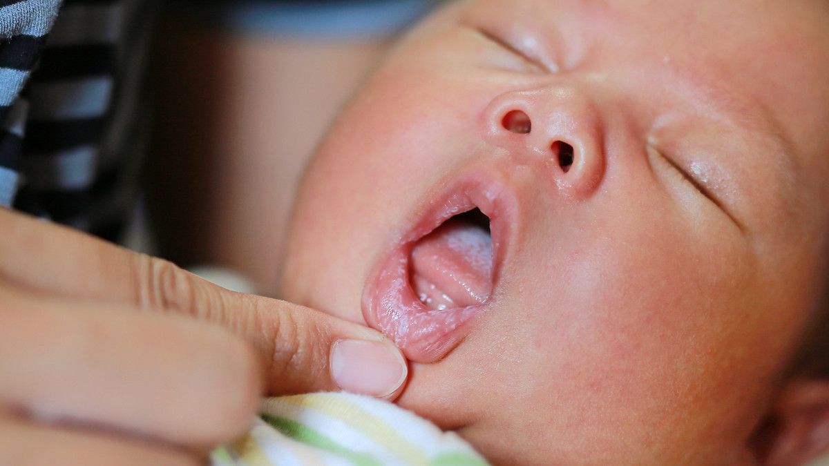Masalah Kesehatan Mulut yang Sering Terjadi pada Bayi, Apa Saja?