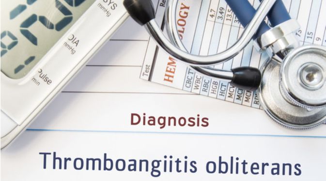 Penyakit Thromboangiitis (Shidlovski/Shutterstock)
