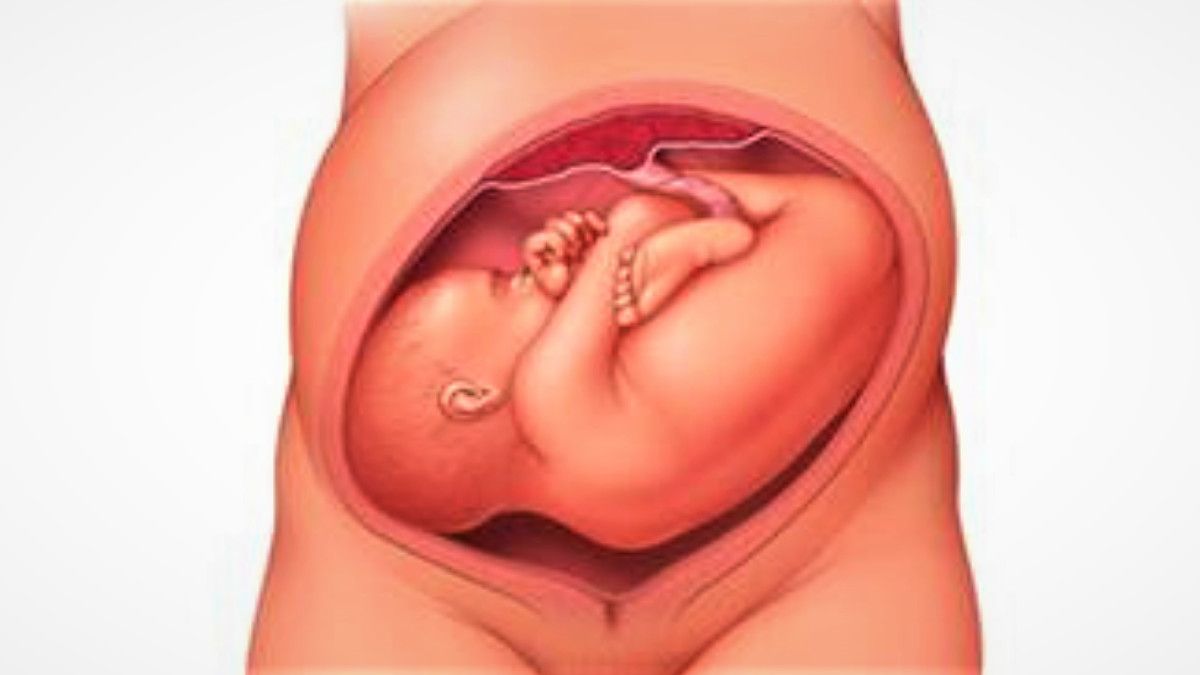 Posisi Bayi Melintang, Bisakah Berubah Menjelang Kelahiran?