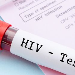 Pemeriksaan HIV