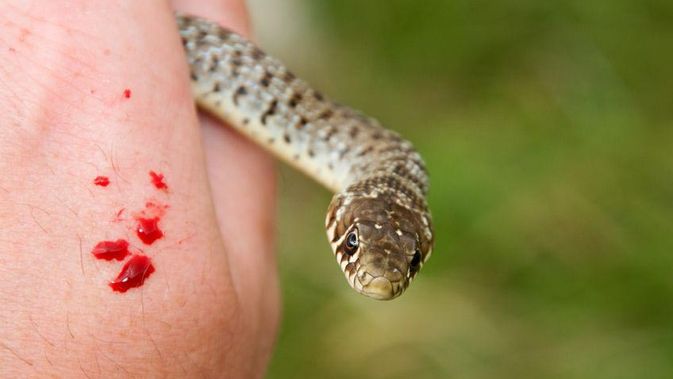 Pertama kobra ular pertolongan digigit 9 Pertolongan